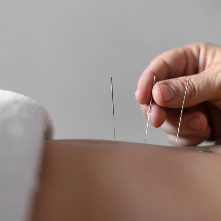 close-up-hand-holding-acupuncture-needle